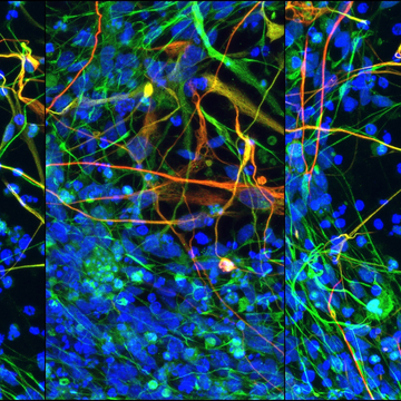Vědci hledají nové možnosti regenerace nervové tkáně pomocí molekul mikroRNA