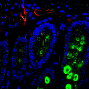 Exploring Mitochondria as Targets in Cancer Development and Therapy