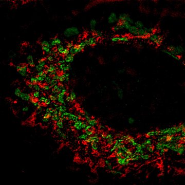 BIOCEV Researchers Have Forced Cancer Cells to Self-Destruct