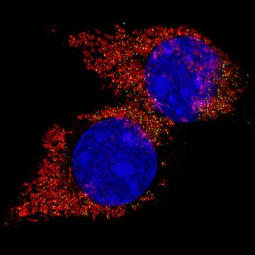 Nová role mitochondrií v nádorovém bujení