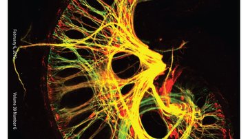 Central Effects of Neurod1 Knockout in Inner Ear