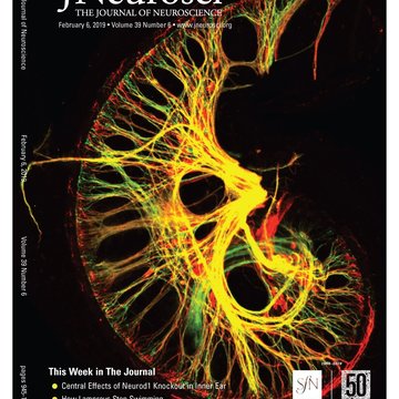 Central Effects of Neurod1 Knockout in Inner Ear