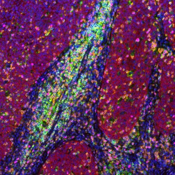 MICOBION EMBL Course: Methods of Functional Genomics