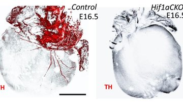 HIF-1α is required for development of the sympathetic nervous system