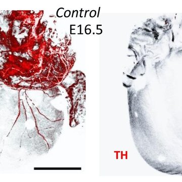 HIF-1α is required for development of the sympathetic nervous system