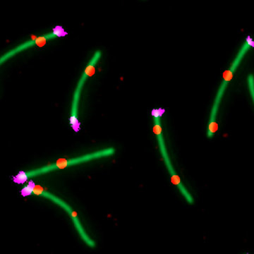 České myši (a čeští genetici) pomáhají poznávat tajemství štěpení DNA při tvorbě spermií
