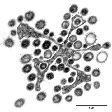 Researchers reveal the metabolic capacity of a termite gut protist and its associated bacteria using single-cell (meta)genomics