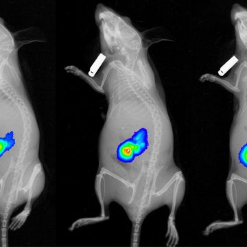 Vitamin C shows promise for the treatment of rare cancers