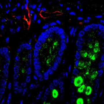 The new laboratory of IBT CAS will focus on the metabolism of healthy tissue and tumor