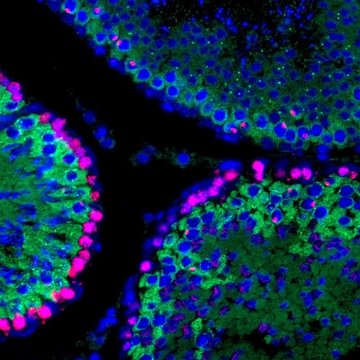 Localization of programmed DNA breaks in the rat germ cells