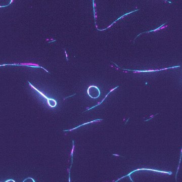 New perspective on forces that divide cells