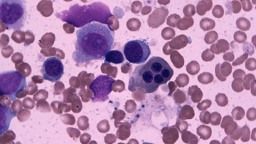 Czech physicians and researchers to prolong the lives of people with leukaemia