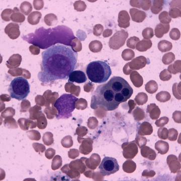 Czech doctors and scientists will extend the lives of people with leukaemia