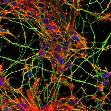 Tau protein on the trail