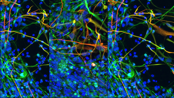 Scientists are looking for new ways to regenerate nerve tissue using microRNA molecules