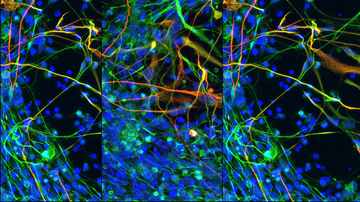 Vědci hledají nové možnosti regenerace nervové tkáně pomocí molekul mikroRNA