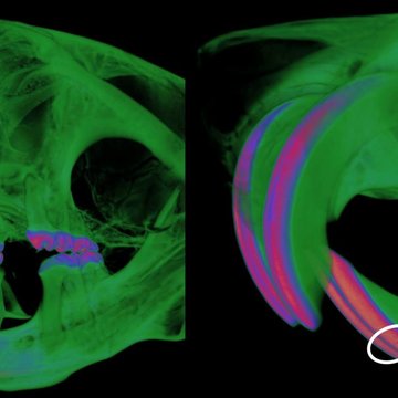 A link between autoimmune disorders and tooth enamel defects revealed