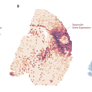Groundbreaking study maps brain’s recovery process after stroke using spatial transcriptomics