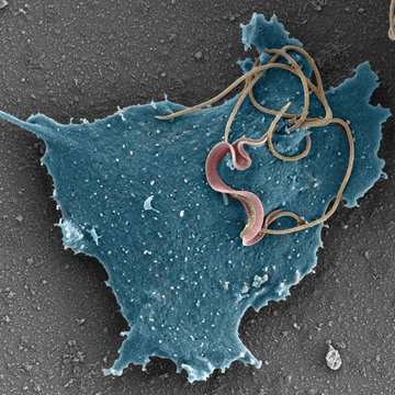 Život bez kyslíku mění strukturu mitochondriálních proteinů