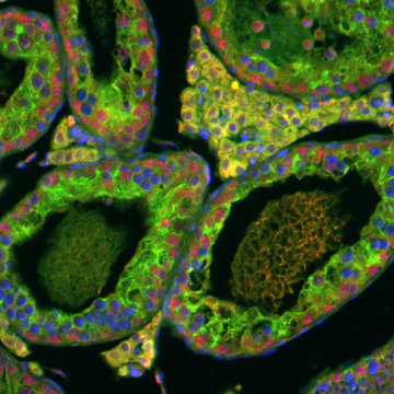 Development of Diagnostic and Therapeutic Procedures